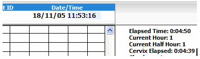 Partograph time display